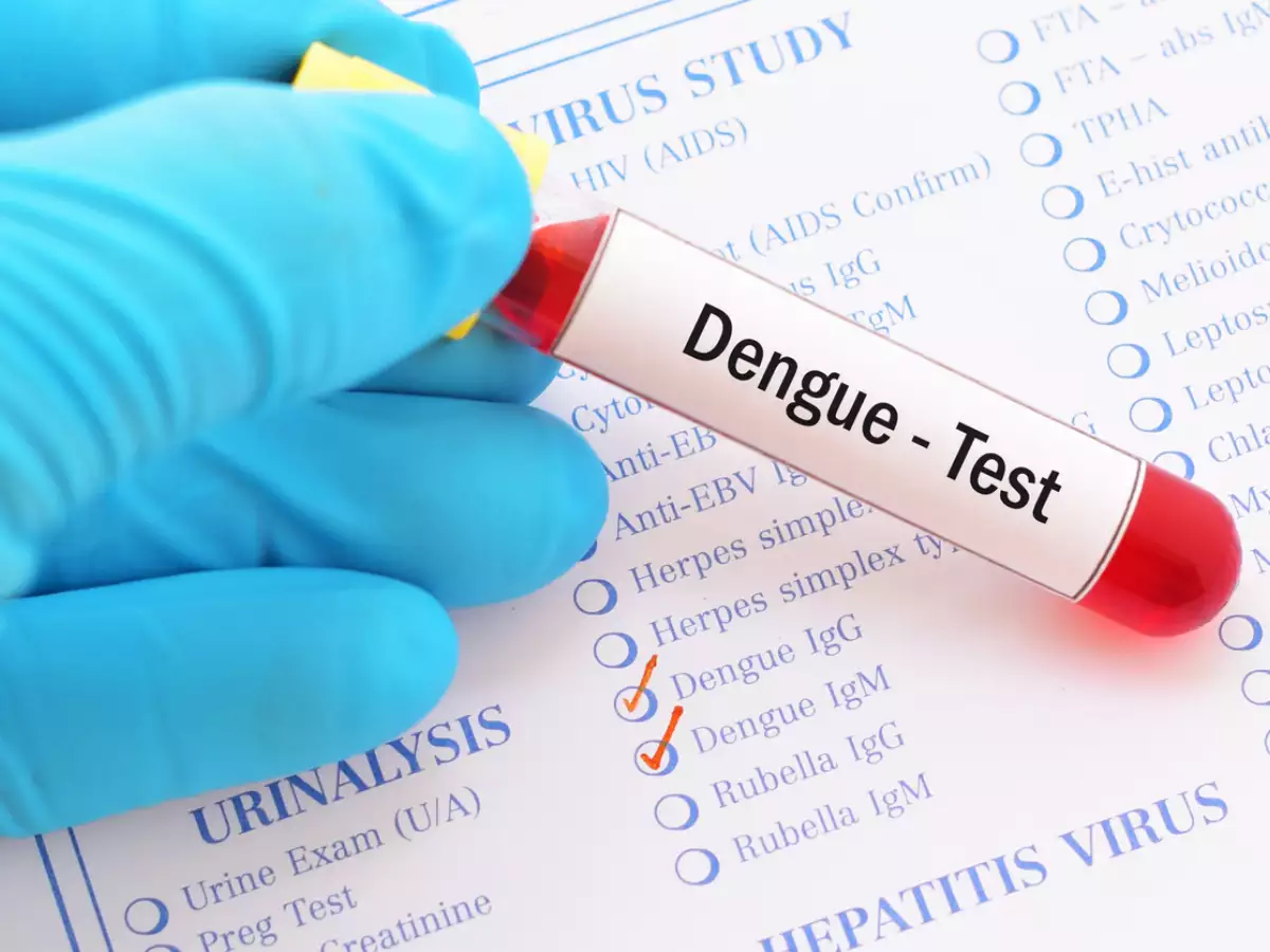 Dengue case on the rise up in Islamabad