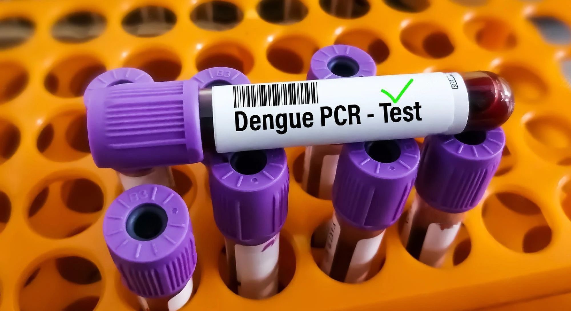 Dengue Virus Cases Start Decrease As Temperature Fall in KP. 