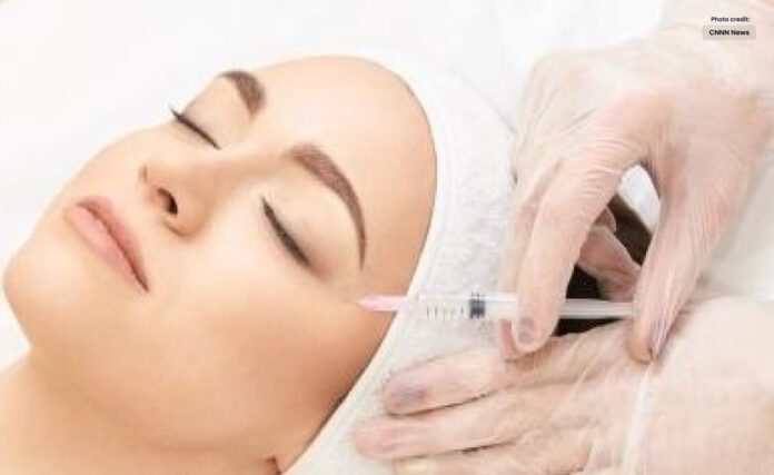 Botox Users Profess to Perceive Less Anxiety