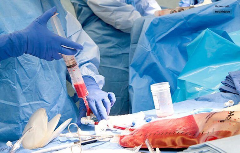 The Remarkable Potential of Bone Marrow Transplants