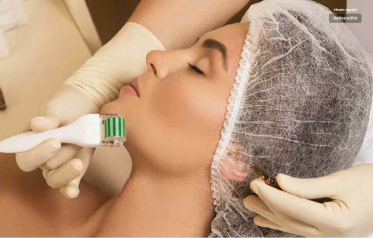 Dermaroller A Revolutionary Tool for Skin Rejuvenation and Repair