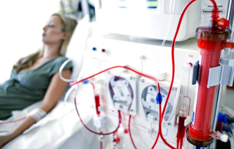 Hemodialysis: A Lifesaving Journey of Renal Support