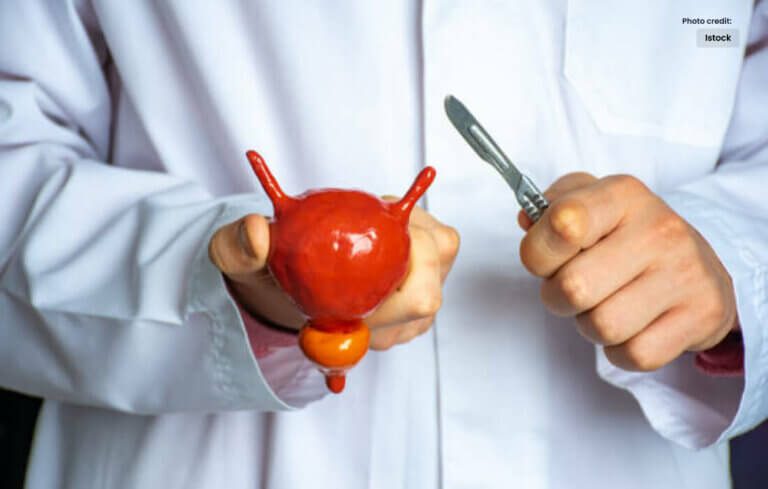 TURP (Transurethral Resection of the Prostate)