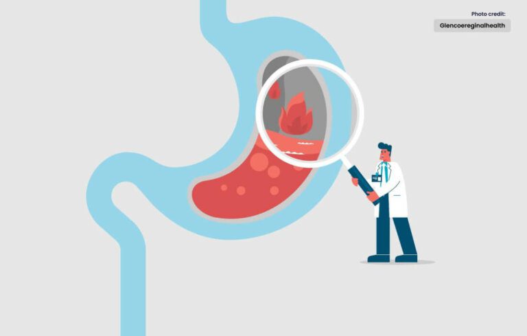 Finding Relief: Effective GERD Treatment Options