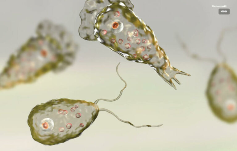 In Karachi, Naegleria Takes Another Life