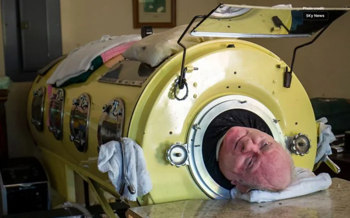 Paul Alexander, Living on Artificial Iron Lung, Passed Away