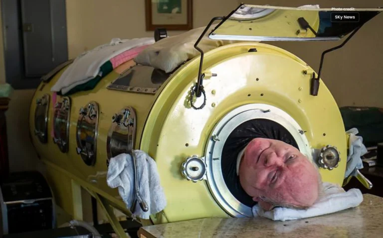 Paul Alexander, Living on Artificial Iron Lung, Passed Away