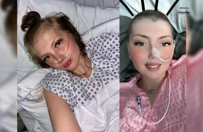 Tiktok Star Leah Smith has Died of Rare Bone Cancer