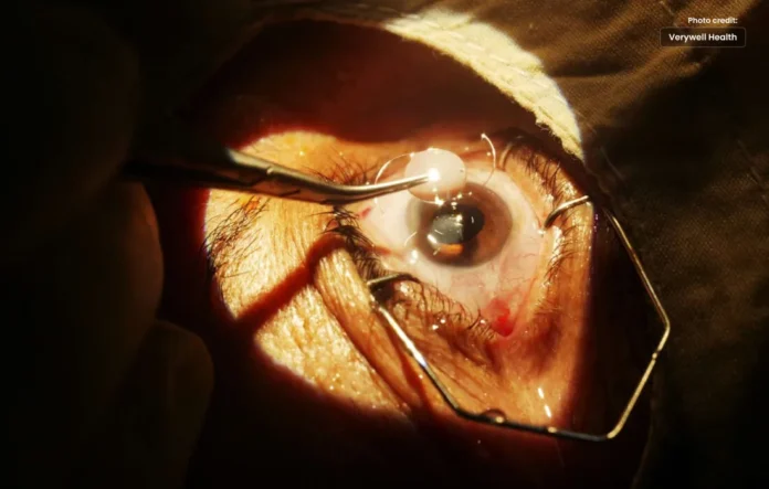 What are the Disadvantages of Cataract Surgery?