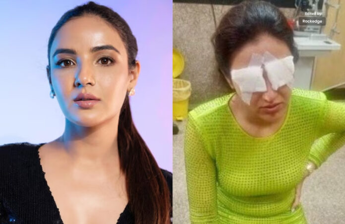 Jasmin Bhasin's Eyes were Affected by Contact Lenses